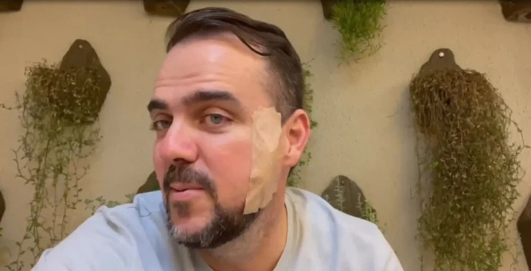 Gustavo Mendanha faz cirurgia contra um câncer de pele: “estou bem”