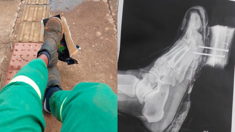 Os riscos do descarte incorreto de objetos perfurocortantes para os trabalhadores da Comurg