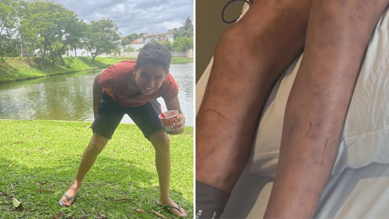 Menino de 9 anos é internado em estado grave após ataque de abelhas em Catalão 