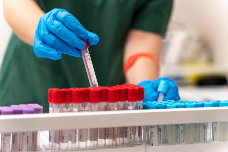 Goiânia passa a oferecer coleta de exames laboratoriais em unidades de saúde abertas aos sábados