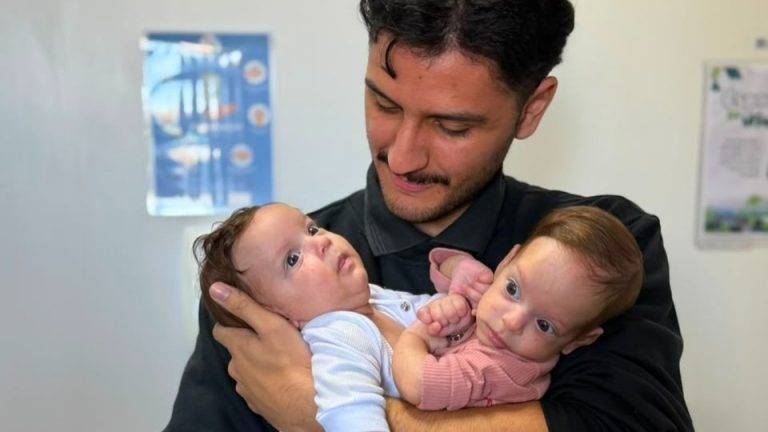 As gêmeas siamesas Maria Helena e Maria Eva, de 3 meses, naturais de São Paulo, iniciaram nesta segunda-feira (27) o acompanhamento no Hecad. Foto: Lais Castilho